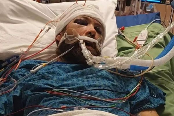 Colorado Man Taken Off from Life Support Weeks After ‘Brutal’ Head Injury in Random Attack in Westminster