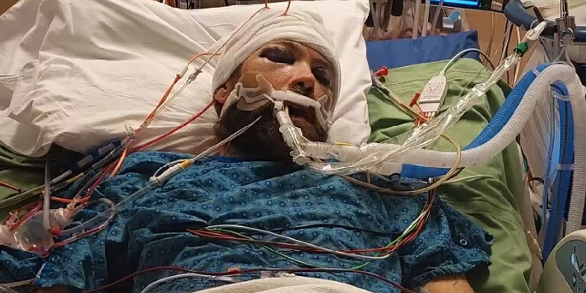 Colorado Man Taken Off from Life Support Weeks After ‘Brutal’ Head Injury in Random Attack in Westminster